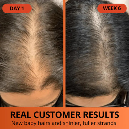 Pumpkin Seed Oil Softgels