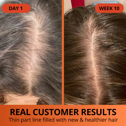 Pumpkin Seed Oil Softgels