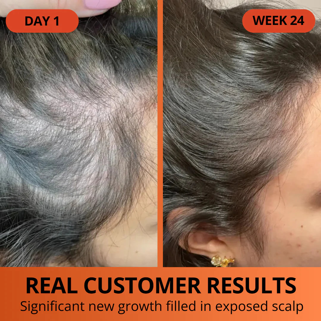 Pumpkin Seed Oil Softgels